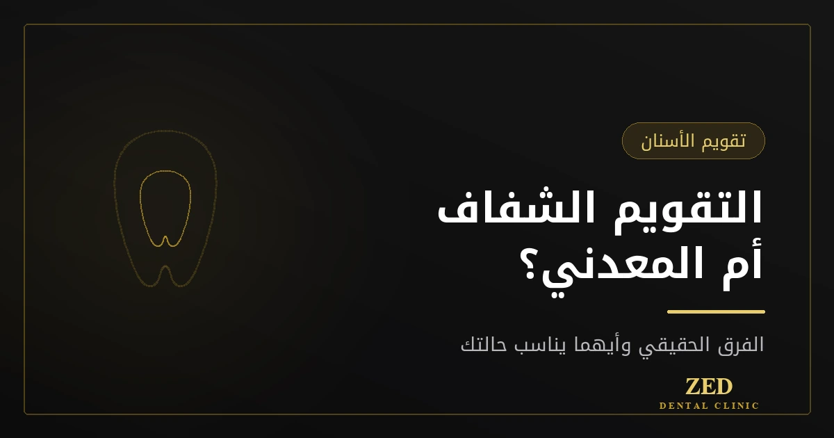 غلاف مقال التقويم الشفاف أم المعدني من مركز زد للأسنان