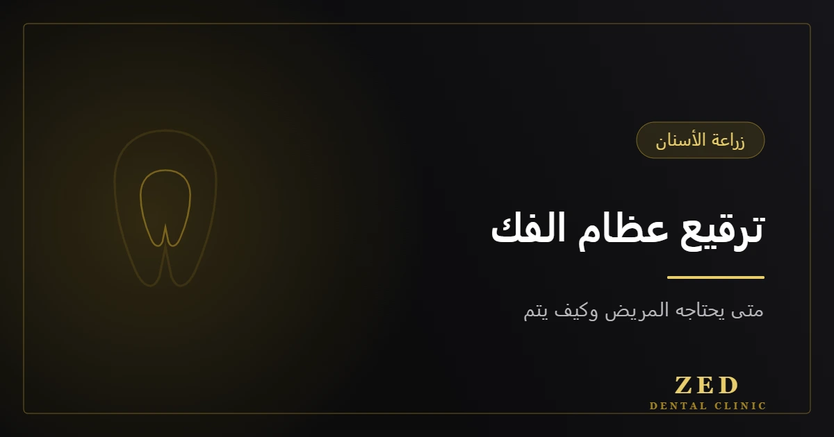 غلاف مقال ترقيع عظام الفك من مركز زد للأسنان