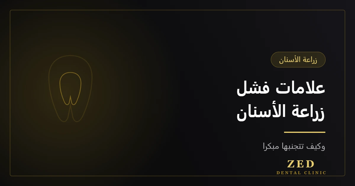 غلاف مقال علامات فشل زراعة الأسنان من مركز زد للأسنان
