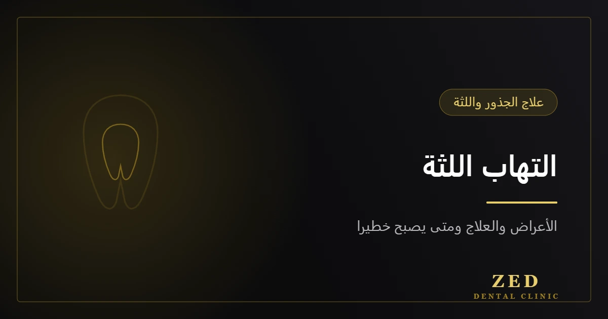 غلاف مقال التهاب اللثة من مركز زد للأسنان