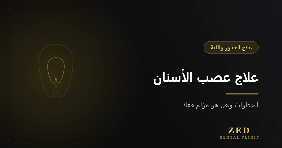 غلاف مقال علاج عصب الأسنان من مركز زد للأسنان