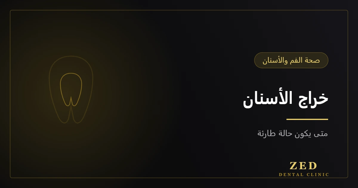 غلاف مقال خراج الأسنان من مركز زد للأسنان