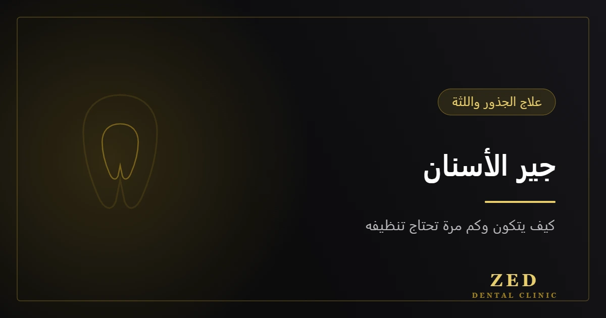 غلاف مقال جير الأسنان وتنظيفه من مركز زد للأسنان