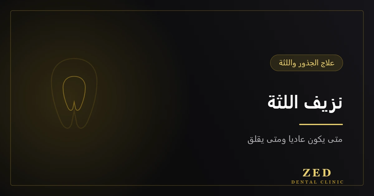غلاف مقال نزيف اللثة من مركز زد للأسنان