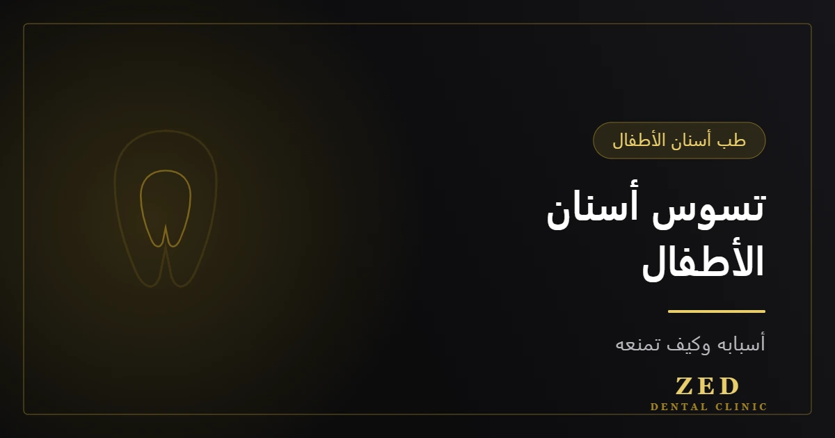 غلاف مقال تسوس أسنان الأطفال من مركز زد للأسنان