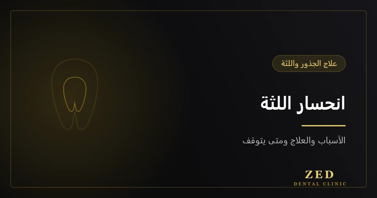 غلاف مقال انحسار اللثة من مركز زد للأسنان