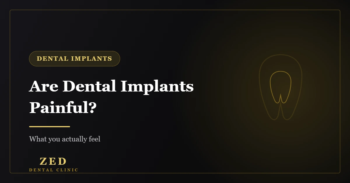 Cover image for Are Dental Implants Painful? - Zed Dental Center