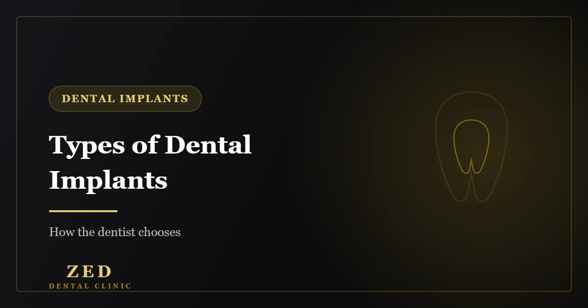Cover image for Types of Dental Implants - Zed Dental Center