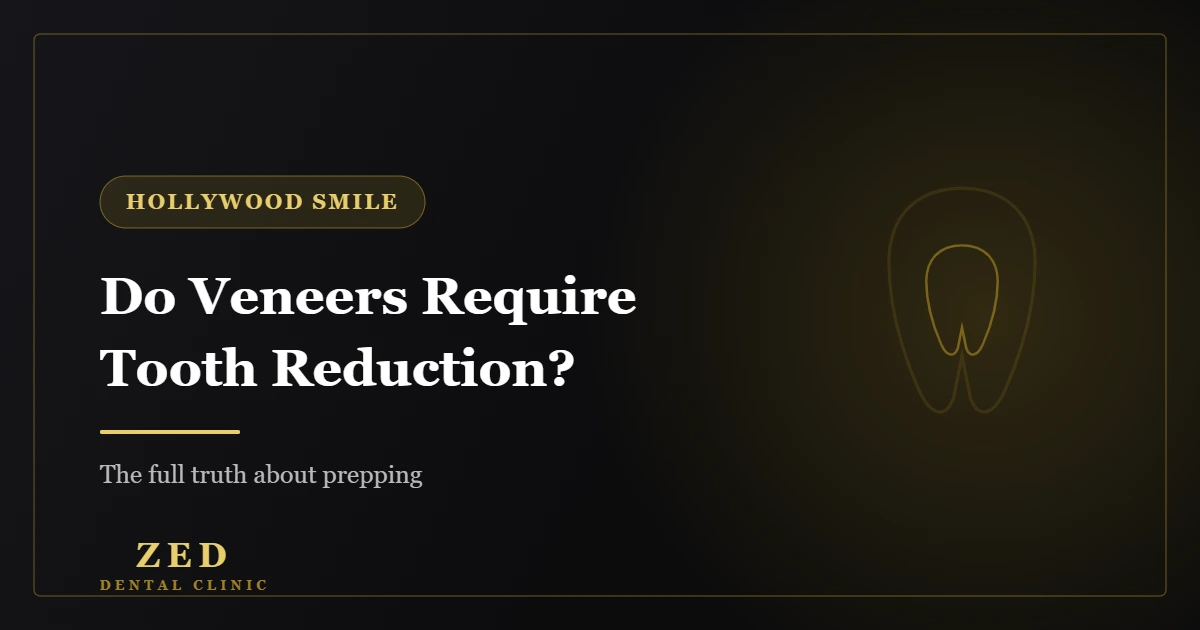 Cover image for Do Veneers Require Tooth Reduction? - Zed Dental Center
