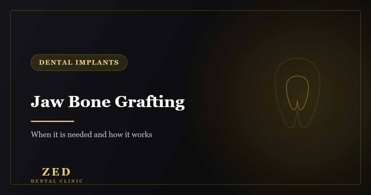 Cover image for jaw bone grafting - Zed Dental Center