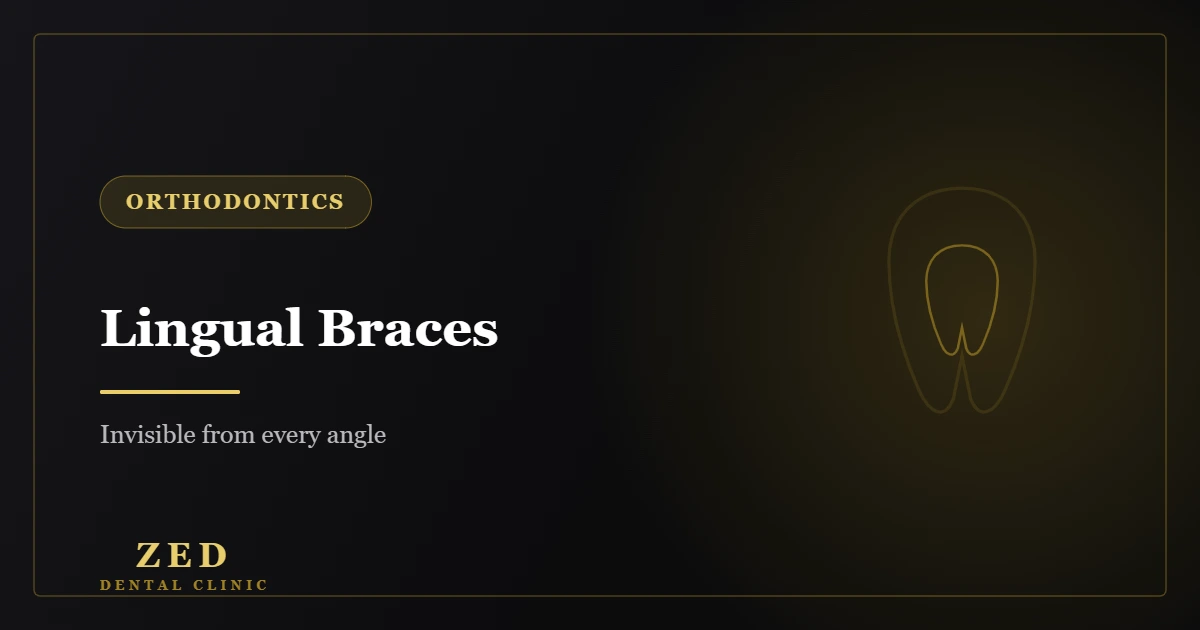 Cover image for lingual braces - Zed Dental Center