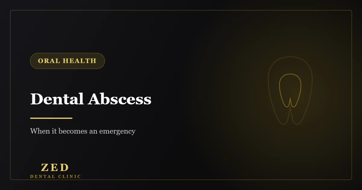 Cover image for dental abscess emergency - Zed Dental Center